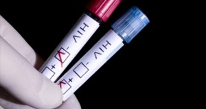 HIV-Test