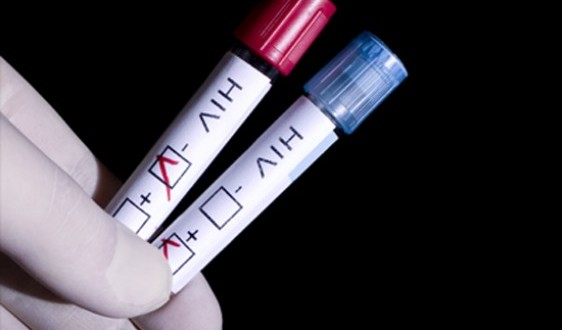 HIV-Test