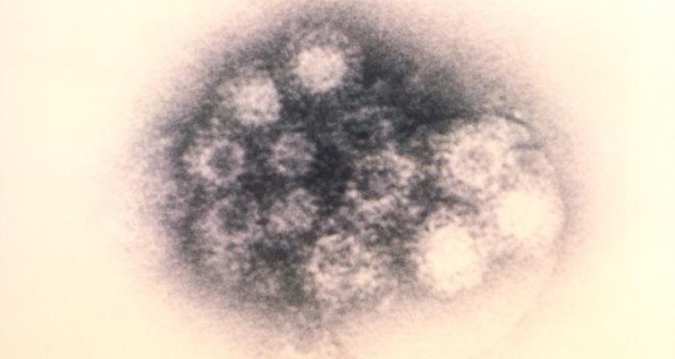Enterovirus - CDC