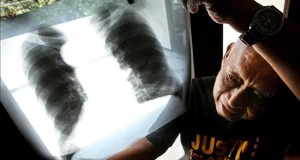 ASCO hará ensayos clínicos en cáncer avanzado con terapias personalizadas
El estudio recogerá información sobre la actividad antitumoral y la toxicidad de los medicamentos que están en el mercado dirigidos contra diversos tipos de cáncer, incluidos los tumores solidos avanzados, el mieloma múltiple o el linfoma no hodgking.