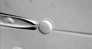 El Reino Unido autoriza la modificación genética de embriones humanos
Imagen microscópica de una célula.