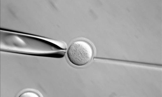 El Reino Unido autoriza la modificación genética de embriones humanos
Imagen microscópica de una célula.