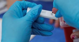 De acuerdo con los últimos datos disponibles, en Cuba viven actualmente unas 23.283 personas con VIH, con una tasa de mortalidad del 17 %. EFE/Archivo