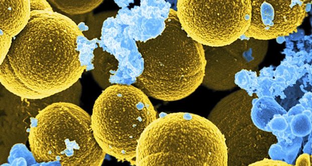 Esta imagen coloreada digitalmente, proporcionada por el Instituto Nacional de Alergias y Enfermedades Infecciosas (NIAID), muestra la bacteria Staphylococcus aureus en amarillo.